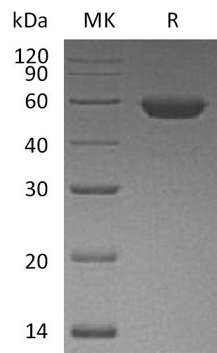 BL-1190NP: Greater than 95% as determined by reducing SDS-PAGE. (QC verified)Recombinant Human ROR2 Protein (C-6His)