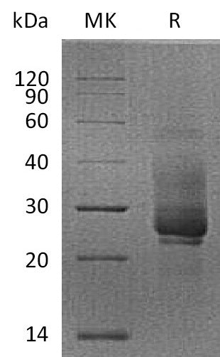 BL-2597NP: Greater than 95% as determined by reducing SDS-PAGE. (QC verified)Recombinant Cynomolgus TIM-3 Protein (N-8His)