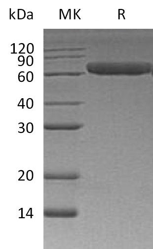 BL-1189NP: Greater than 95% as determined by reducing SDS-PAGE. (QC verified)Recombinant Human ROR1 Protein (C-6His)
