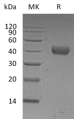 BL-1657NP: Greater than 95% as determined by reducing SDS-PAGE. (QC verified)Recombinant Human CD38 Protein (C-6His)