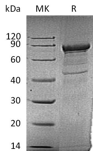 BL-1187NP: Greater than 95% as determined by reducing SDS-PAGE. (QC verified)Recombinant Human TFRC Protein (N-6His)