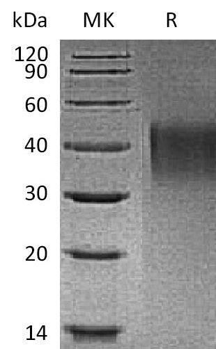 BL-1186NP: Greater than 95% as determined by reducing SDS-PAGE. (QC verified)Recombinant Mouse TIM-1 Protein (C-6His)