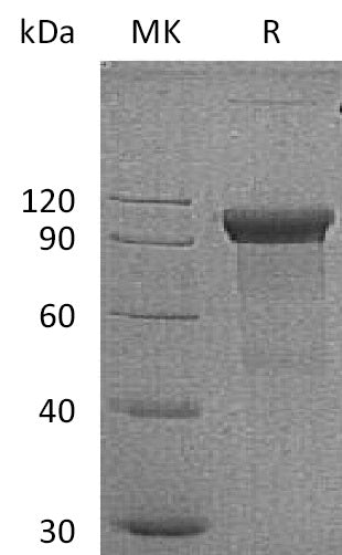 BL-0204NP: Greater than 95% as determined by reducing SDS-PAGE. (QC verified)Recombinant Human ROR1 Protein (C-Fc)