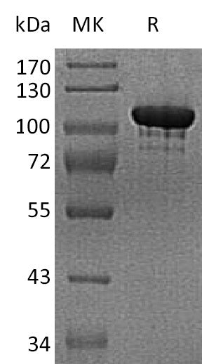 BL-2271NP: Greater than 90% as determined by reducing SDS-PAGE. (QC verified)Recombinant Human ENPP-2 Protein (C-6His)