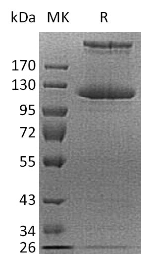 BL-2272NP: Greater than 95% as determined by reducing SDS-PAGE. (QC verified)Recombinant Human COL21A1 Protein (C-6His)