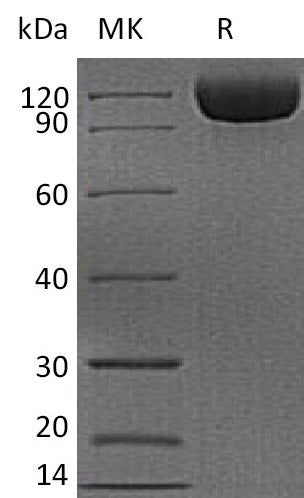 BL-2178NP: Greater than 95% as determined by reducing SDS-PAGE. (QC verified)Recombinant Human CD26 Protein (C-6His)