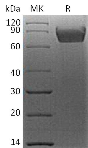 BL-2665NP: Greater than 95% as determined by reducing SDS-PAGE. (QC verified)Recombinant Human B7-H4 Protein (C-mFc)