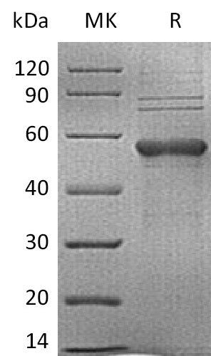 BL-2771NP: Greater than 80% as determined by reducing SDS-PAGE. (QC verified)Recombinant Human TIM-3 Protein (C-mFc)