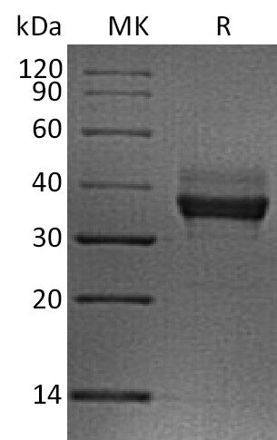 BL-2109NP: Greater than 95% as determined by reducing SDS-PAGE. (QC verified)Recombinant Human LILRB4 Protein (C-6His)