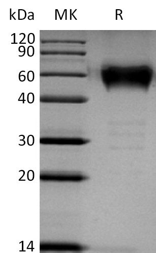 BL-2298NP: Greater than 95% as determined by reducing SDS-PAGE. (QC verified)Recombinant Human BTLA Protein (C-mFc)