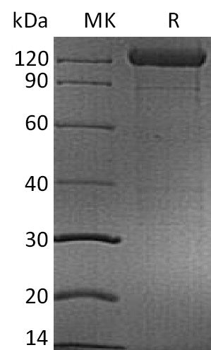 BL-2154NP: Greater than 90% as determined by reducing SDS-PAGE. (QC verified)Recombinant Human CD96 Protein (C-mFc)