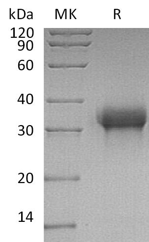 BL-2151NP: Greater than 95% as determined by reducing SDS-PAGE. (QC verified)Recombinant Human Siglec-15 Protein (C-6His)