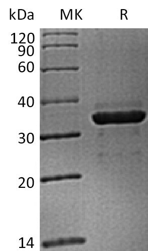 BL-2312NP: Greater than 95% as determined by reducing SDS-PAGE. (QC verified)Recombinant Cynomolgus FGL1 Protein (C-6His)