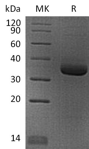 BL-2299NP: Greater than 95% as determined by reducing SDS-PAGE. (QC verified)Recombinant Human ANGPTL4 Protein (N-6His)