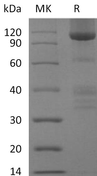 BL-2309NP: Greater than 90% as determined by reducing SDS-PAGE. (QC verified)Recombinant Human GPC3 Protein (C-Fc)