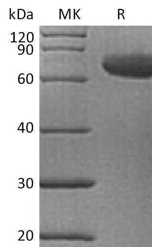 BL-0960NP: Greater than 95% as determined by reducing SDS-PAGE. (QC verified)Recombinant Human IL-23 Protein (C-6His)