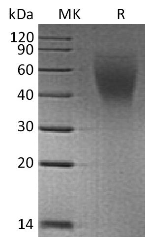 BL-2302NP: Greater than 95% as determined by reducing SDS-PAGE. (QC verified)Recombinant Human CA125 Protein (C-6His)
