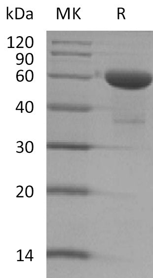 BL-2318NP: Greater than 90% as determined by reducing SDS-PAGE. (QC verified)Recombinant Human TMED1 Protein (C-Fc)