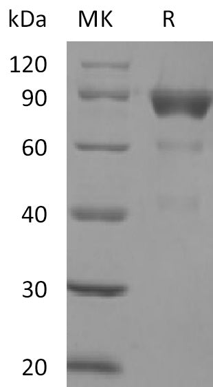 BL-2317NP: Greater than 95% as determined by reducing SDS-PAGE. (QC verified)Recombinant Human SIRPB2 Protein (C-Fc)
