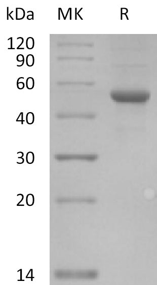 BL-2117NP: Greater than 95% as determined by reducing SDS-PAGE. (QC verified)Recombinant Human ILDR2 Protein (C-Fc)
