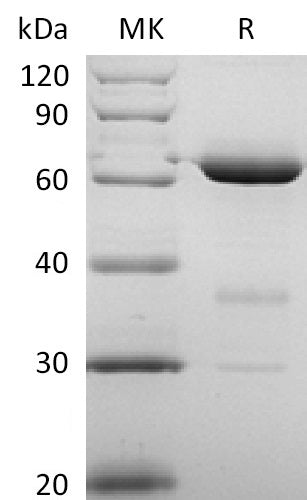 BL-0313NP: Greater than 95% as determined by reducing SDS-PAGE. (QC verified)Recombinant Human CD73 Protein (P21589, C-6His)