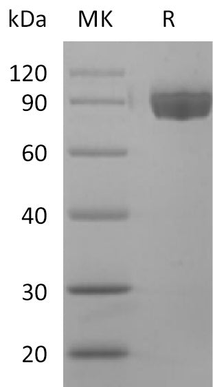 BL-2322NP: Greater than 95% as determined by reducing SDS-PAGE. (QC verified)Recombinant Human Afamin Protein (C-6His)