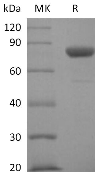 BL-2527NP: Greater than 95% as determined by reducing SDS-PAGE. (QC verified)