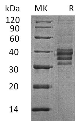 BL-2330NP: Greater than 90% as determined by reducing SDS-PAGE. (QC verified)Recombinant Human Follistatin 288 Protein (C-6His)