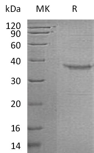 BL-2339NP: Greater than 95% as determined by reducing SDS-PAGE. (QC verified)Recombinant Human GHRH Protein (C-Fc)
