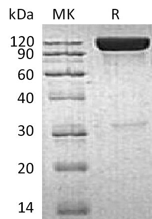 BL-0060NP: Greater than 90% as determined by reducing SDS-PAGE. (QC verified)Recombinant Human ICAM-1 Protein (C-Fc)