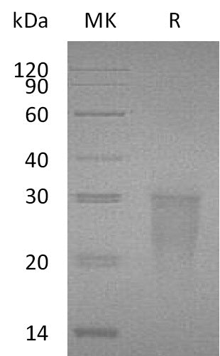 BL-2350NP: Greater than 95% as determined by reducing SDS-PAGE. (QC verified)Recombinant Human TMIGD2 Protein (C-6His)