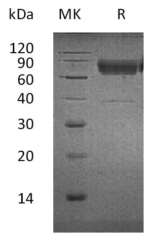 BL-2192NP: Greater than 95% as determined by reducing SDS-PAGE. (QC verified)Recombinant Human CD300a Protein (C-Fc-6His)