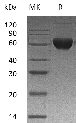 BL-2364NP: Greater than 95% as determined by reducing SDS-PAGE. (QC verified)Recombinant Human ACVR2B Protein (C-Fc-6His)