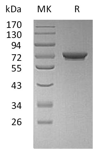 BL-1454NP: Greater than 95% as determined by reducing SDS-PAGE. (QC verified)Recombinant Human GALNT7 Protein (C-6His)
