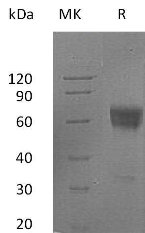 BL-2355NP: Greater than 95% as determined by reducing SDS-PAGE. (QC verified)Recombinant Human FAS Protein (C-Fc)