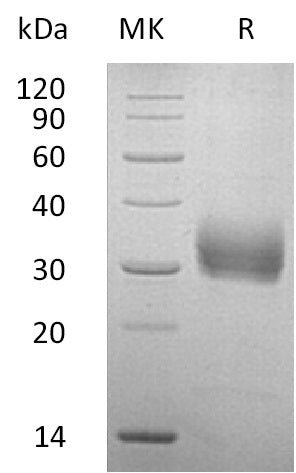 BL-0791NP: Greater than 95% as determined by reducing SDS-PAGE. (QC verified)Recombinant Human SOST Protein (C-6His)