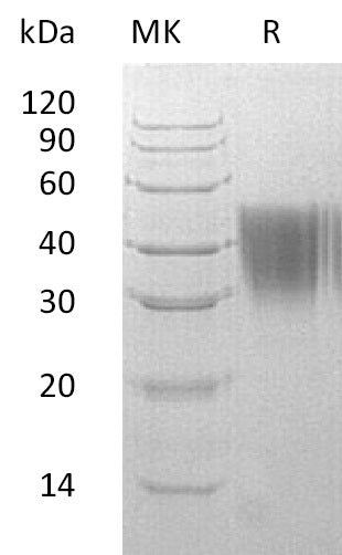 BL-0793NP: Greater than 95% as determined by reducing SDS-PAGE. (QC verified)Recombinant Human AGP2 Protein (C-6His)