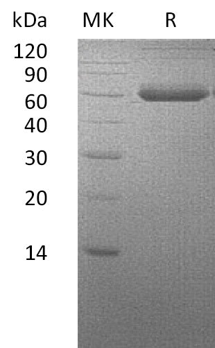 BL-2365NP: Greater than 95% as determined by reducing SDS-PAGE. (QC verified)Recombinant Human BMPR1A Protein (C-Fc-6His)