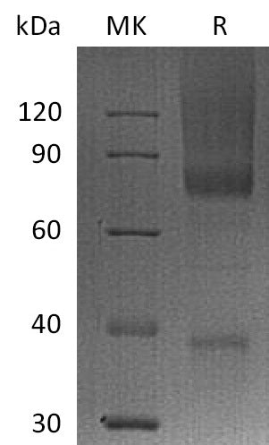 BL-2404NP: Greater than 95% as determined by reducing SDS-PAGE. (QC verified)