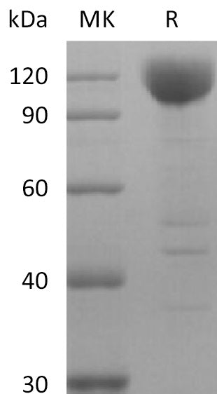 BL-2617NP: Greater than 95% as determined by reducing SDS-PAGE. (QC verified)