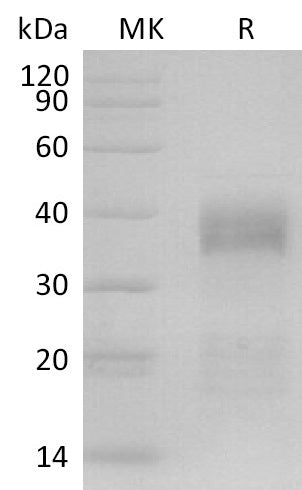 BL-2638NP: Greater than 90% as determined by reducing SDS-PAGE. (QC verified)