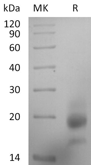 BL-2856NP: Greater than 95% as determined by reducing SDS-PAGE. (QC verified)Recombinant Human RSPO3 Protein (C-6His)