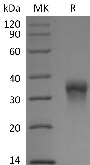 BL-2855NP: Greater than 95% as determined by reducing SDS-PAGE. (QC verified)Recombinant Rhesus Macaque FOLR1 Protein (C-6His)