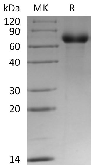 BL-0441NP: Greater than 95% as determined by reducing SDS-PAGE. (QC verified)Recombinant Human LRP12 Protein (C-6His)