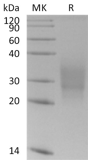 BL-0549NP: Greater than 95% as determined by reducing SDS-PAGE. (QC verified)Recombinant Human CD300a Protein (C-6His)