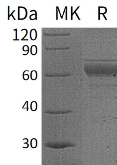 BL-0239NP: Greater than 90% as determined by reducing SDS-PAGE. (QC verified)Recombinant Human IL-20RB Protein (C-Fc)