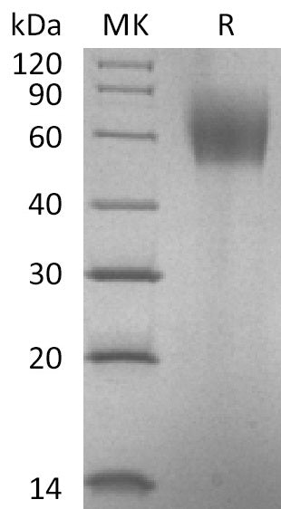 BL-1062NP: Greater than 95% as determined by reducing SDS-PAGE. (QC verified)Recombinant Human IL-23R Protein (C-6His)