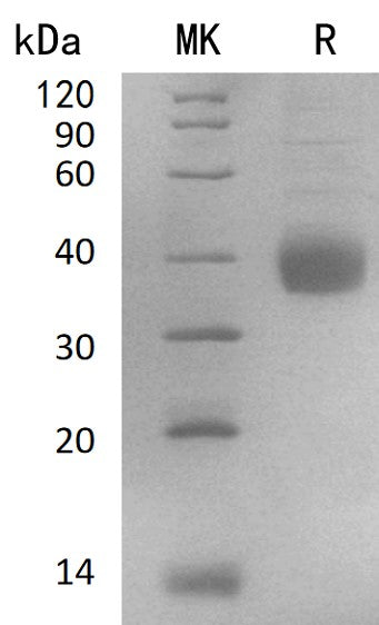 BL-2770NP: Greater than 90% as determined by reducing SDS-PAGE. (QC verified)Recombinant Human NACHRA5 Protein (C-6His)