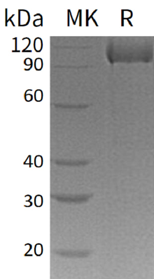 BL-1364NP: Greater than 95% as determined by reducing SDS-PAGE. (QC verified)Recombinant Human Complement Factor MASP3 Protein (C-6His)