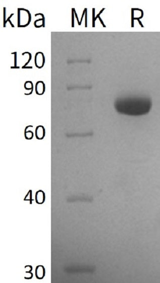 BL-1594NP: Greater than 85% as determined by reducing SDS-PAGE. (QC verified)Recombinant Human GALNT3 Protein (C-6His)
